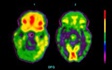 Medical Physics applications to support GCSE and A Level